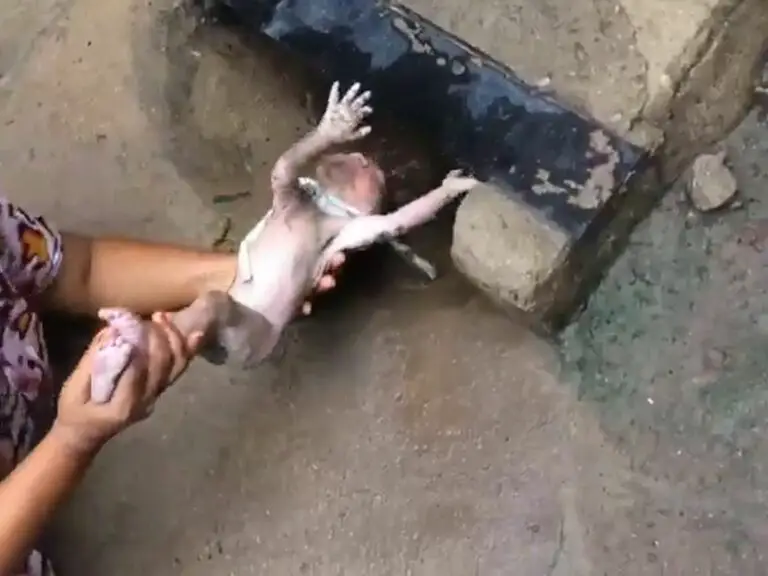 Spiritual Meaning of Umbilical Cord around Neck