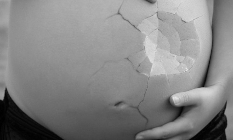 Biblical Meaning of Dream About Miscarriage