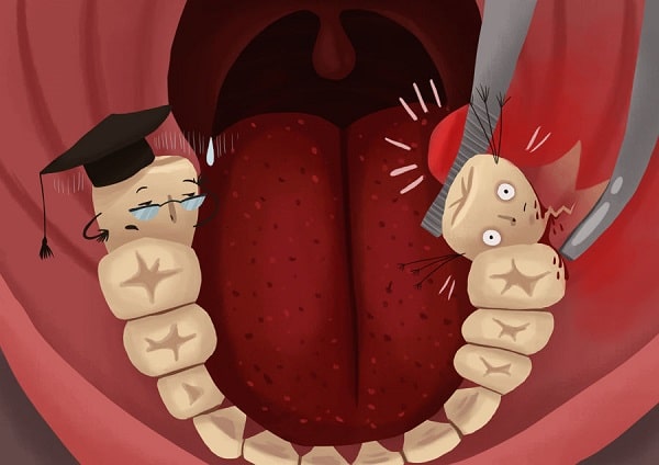 No Wisdom Teeth Spiritual Meaning