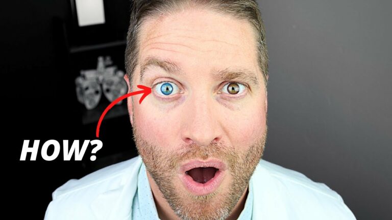 Central Heterochromia Spiritual Meaning
